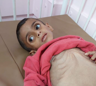 “حماس”: الاحتلال يكرّس التجويع في غزة تحت غطاء مشاريع إغاثية مضلّلة