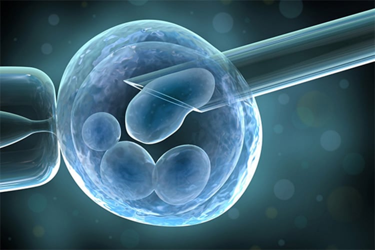جزائريات يقبلن على التلقيح الاصطناعي وتجميد البويضات