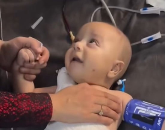 شاهد فيديو لرضيع فلسطيني بترت ساقه بالكامل