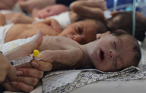 “ما أحوجنا لمروءة الجاهلية”.. أنأكل الطعام وأهل غزة يموتون جوعا؟