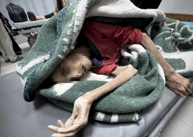 فيديو صادم يكشف فظاعة التجويع في غزة.. ثلاثينية تفارق الحياة بوزن طفل!