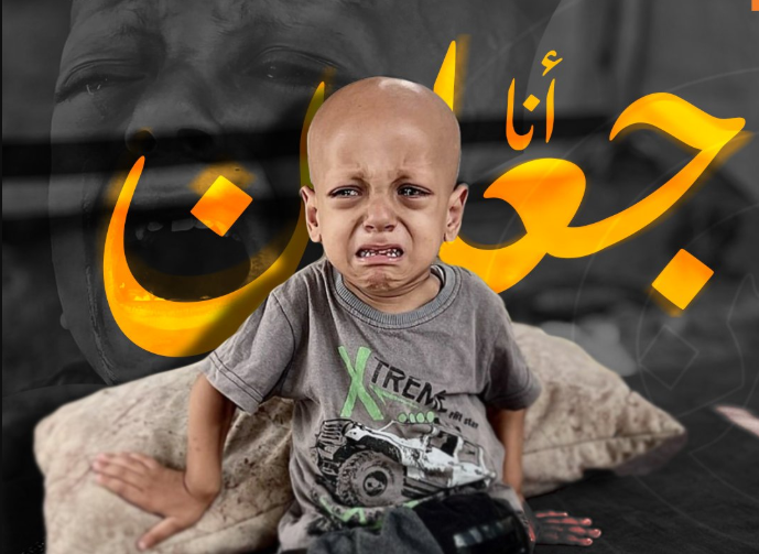رحيل الطفل عبد الله صاحب صرخة “أنا جوعان”.. وهذا حال شقيقته حبيبة!