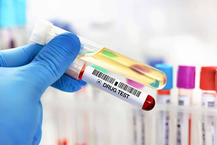 تحاليل المخدرات غير مطلوبة حاليا في ملفات التوظيف