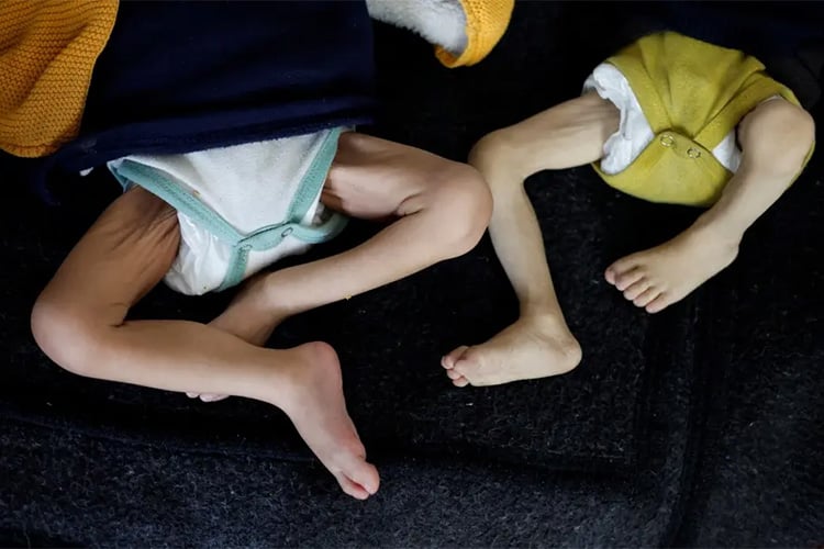 مأساة التجويع بغزة تكشف الوجه القبيح للمنظومة الدولية