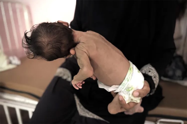 الاحتلال انتقل من سياسة التجويع إلى هندسة “المجاعة”