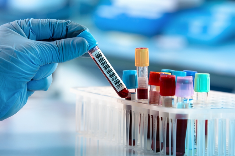 الجزائر – هذه تفاصيل فحوصات الكشف عن المخدرات في إطار التوظيف – الشروق أونلاين